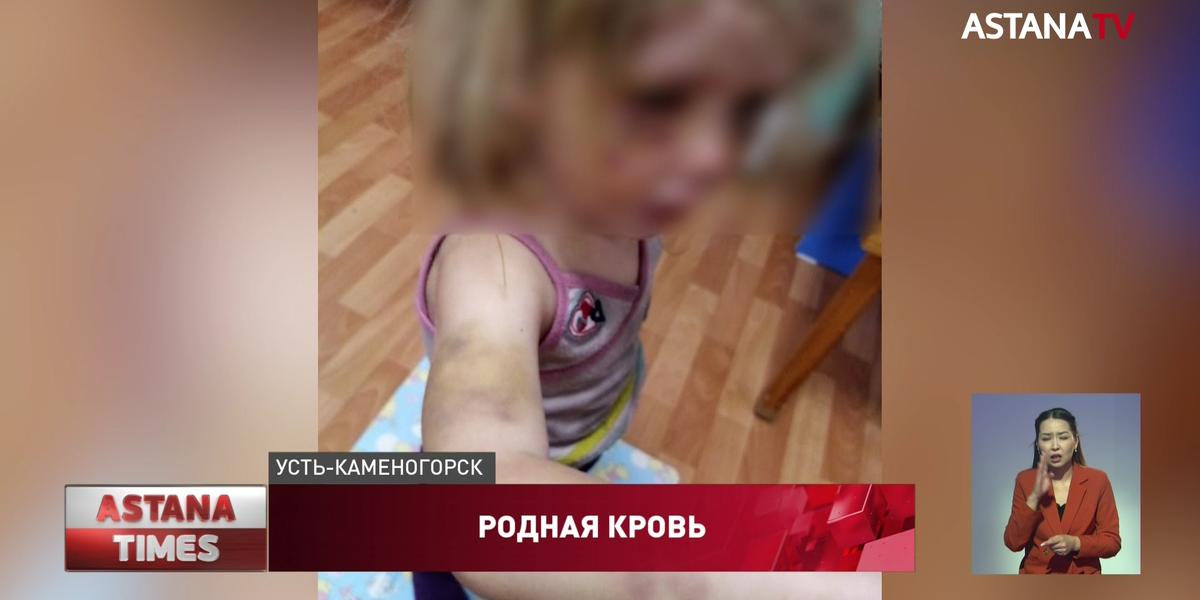 Гнался с ножом: двух маленьких девочек зверски избил родной брат в Усть-Каменогорске
