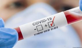 71 адамнан коронавирус инфекциясы анықталды