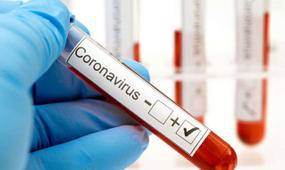 Бір күнде 46 адам коронавирус инфекциясын жұқтырды