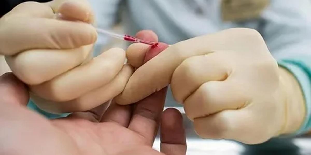 Жыл сайын 3 мыңнан астам қазақстандық АИТВ инфекциясын жұқтырады